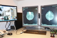 Estación de procesamiento de imágenes diagnósticas (mamografía)